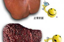 什么是弥漫性肝病,弥漫性肝病的病因、危害与治疗概述